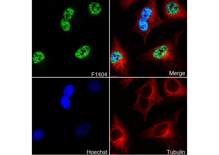 MLL1 C-terminal Antibody