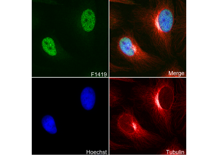 MacroH2A1.1 Antibody