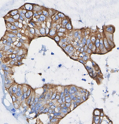 Spinophilin Antibody