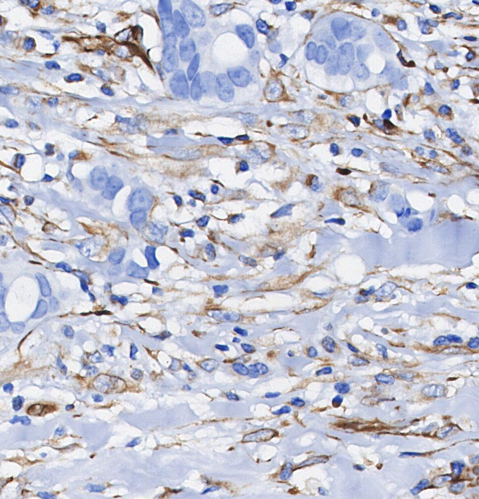 Gelsolin Antibody