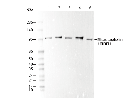 Microcephalin-1/BRIT1 Antibody