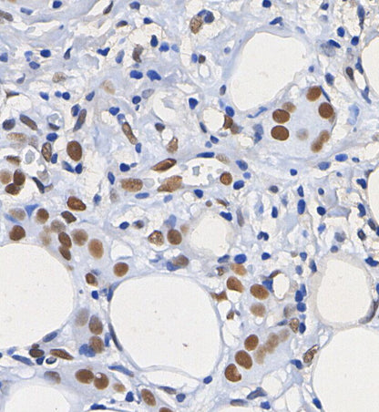 ATF-2 Antibody