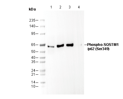 Phospho-SQSTM1/p62 (Ser349) Antibody