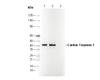 Cardiac Troponin T Antibody