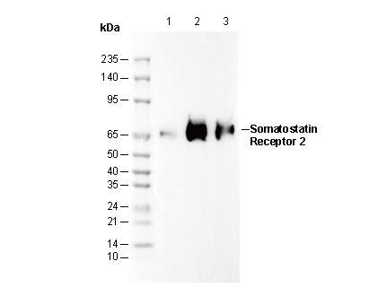 Somatostatin Receptor 2 Antibody