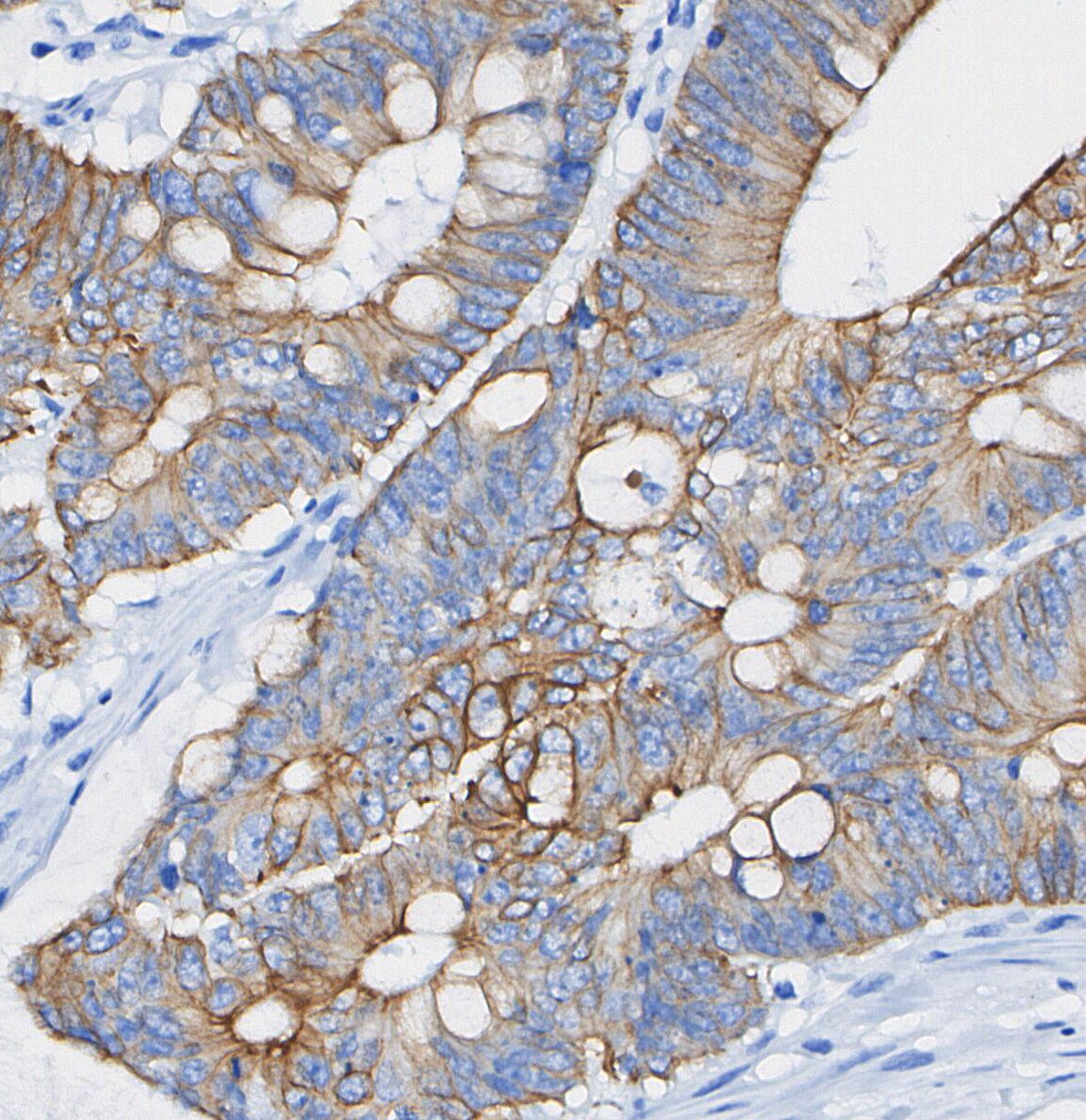 PBR Antibody