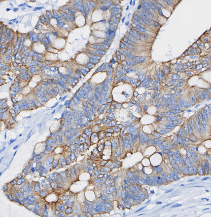 PBR Antibody