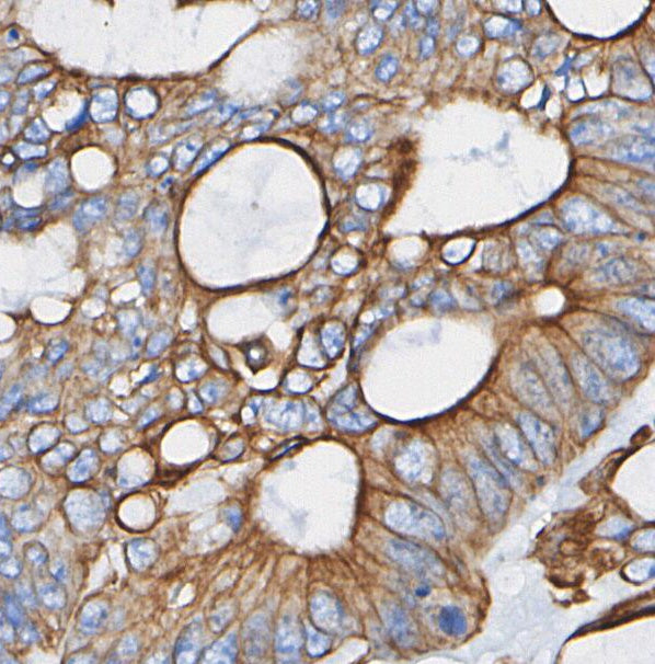 Aquaporin 1 Antibody