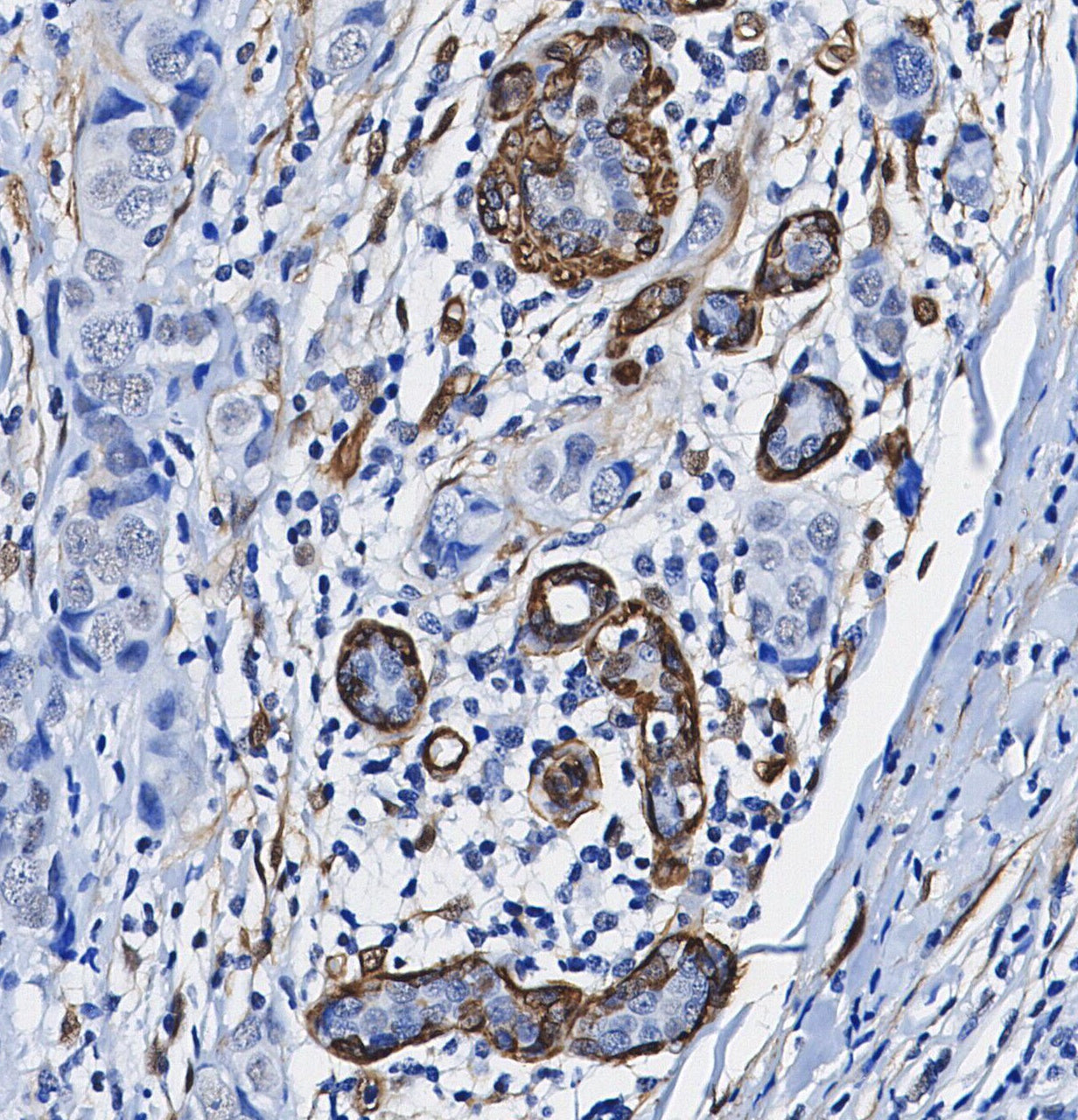 BDNF Antibody