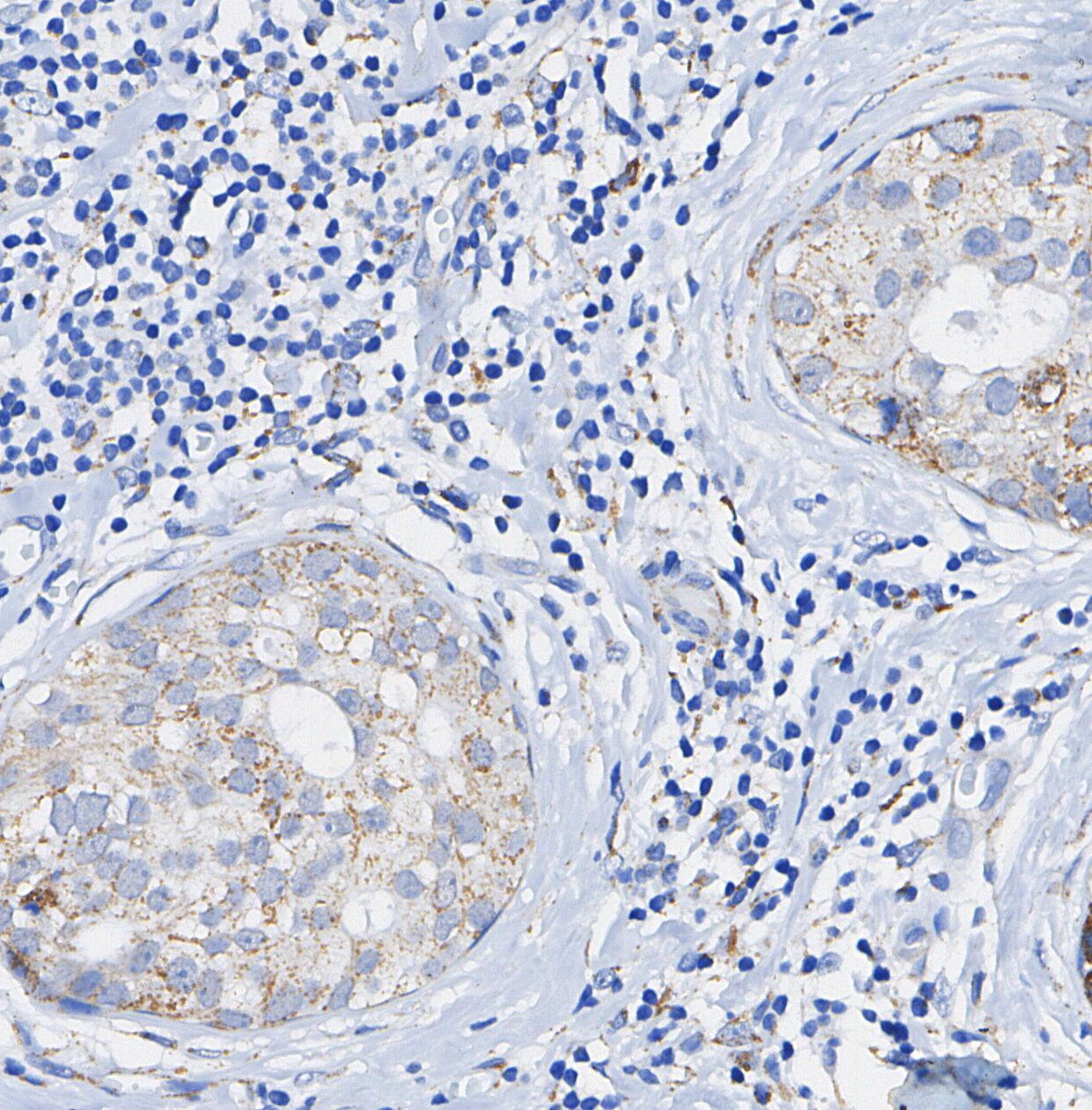 UQCRC2 Antibody