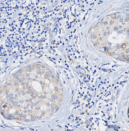 UQCRC2 Antibody