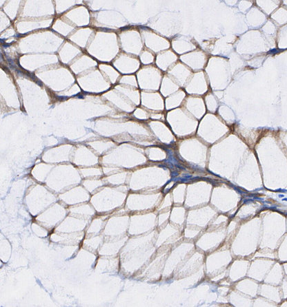 FABP4 Antibody
