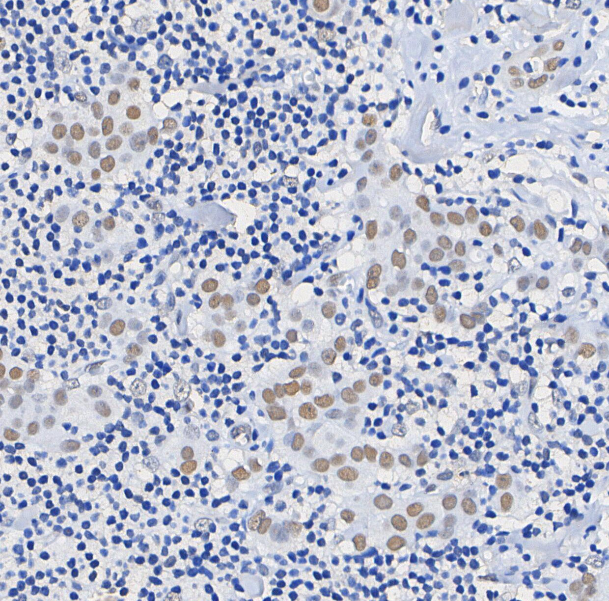 Phospho-c-Myb (Ser11) Antibody