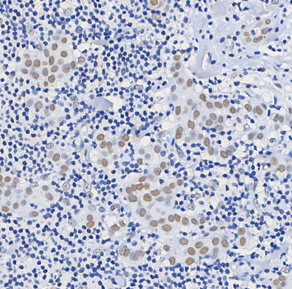 Phospho-c-Myb (Ser11) Antibody