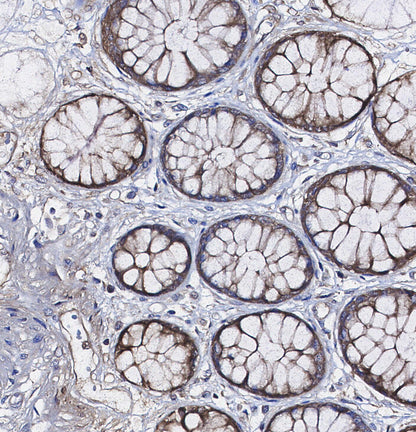ATPB Antibody