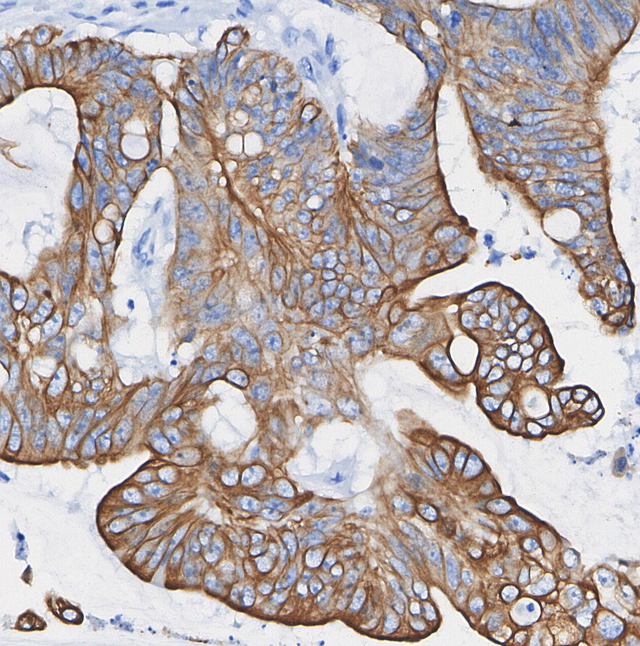 Cytokeratin 8 Antibody