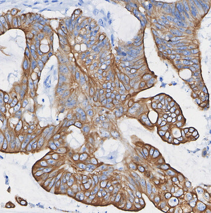 Cytokeratin 8 Antibody