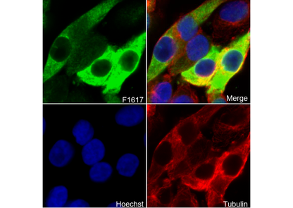 S100 β Antibody