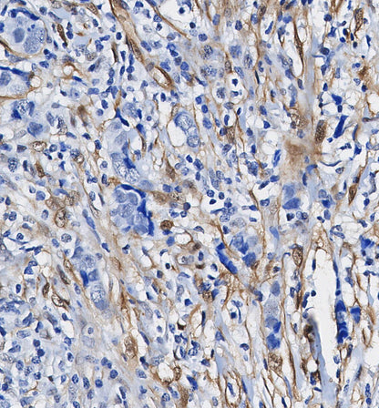 S100 β Antibody