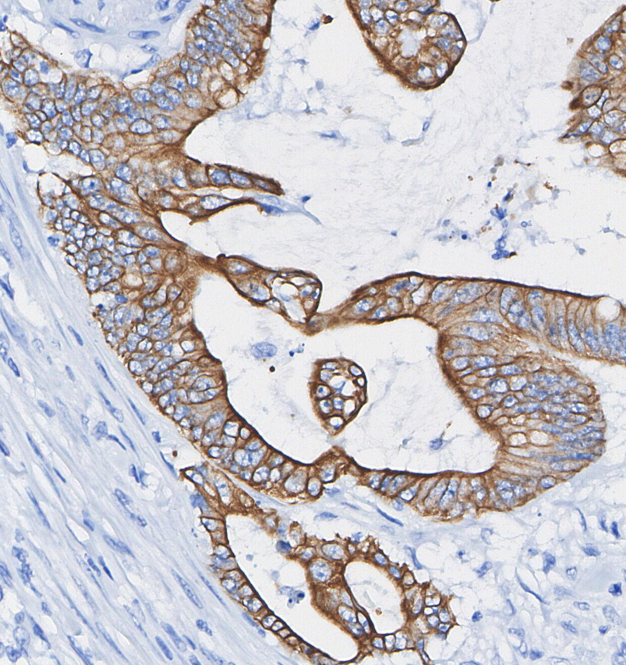 Cytokeratin 14 Antibody