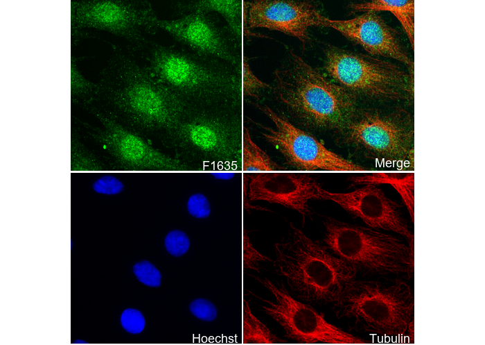 Ctip1/BCL-11A Antibody