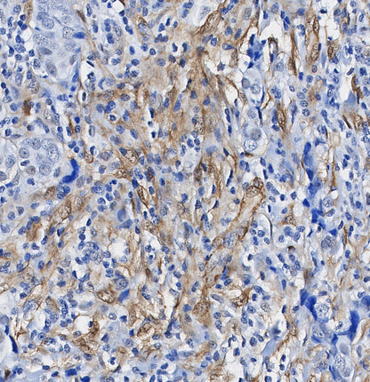 Filamin A Antibody
