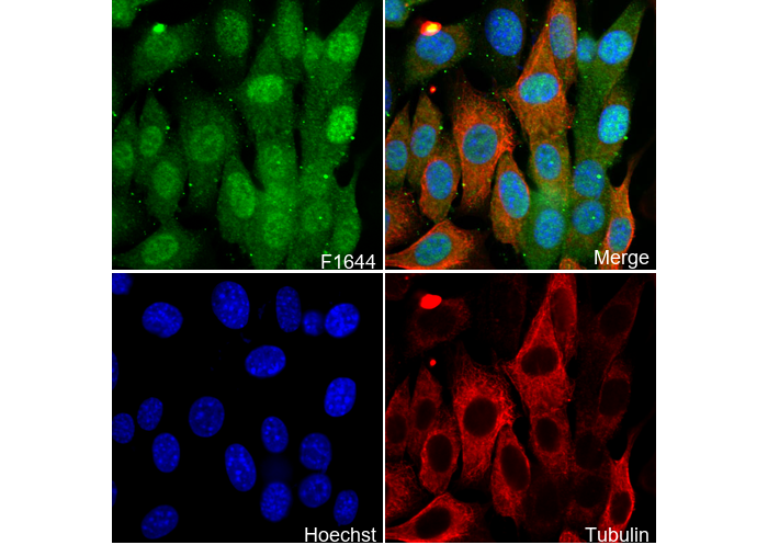 Phospho-AKT1/2/3 (Ser473/474/472) Antibody