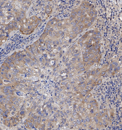 MSI2 Antibody