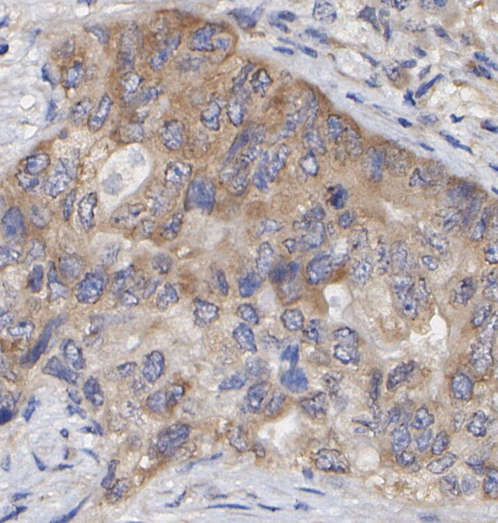 DKK1 Antibody