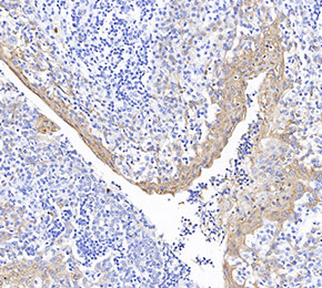 S100A9 + Calprotectin (S100A8/A9 complex) Antibody