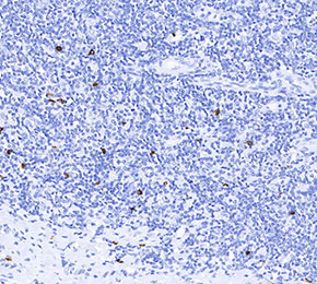 Mast Cell Tryptase Antibody