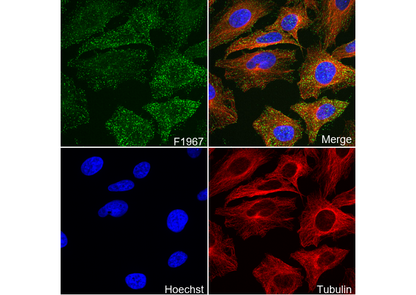 Phospho-AP2M1 (Thr156) Antibody