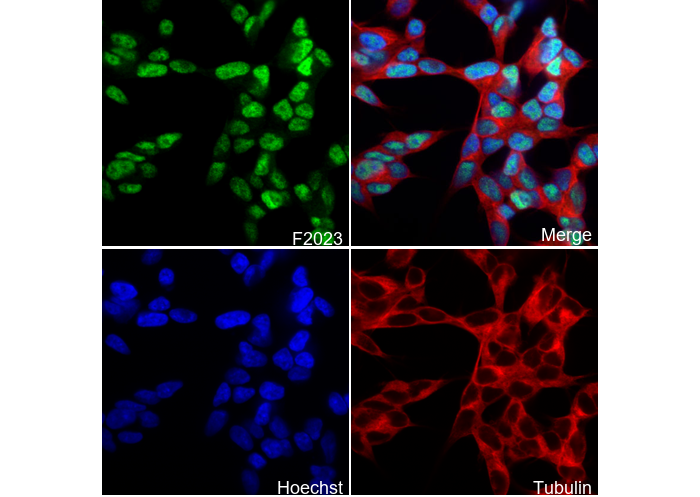 PMS2 Antibody