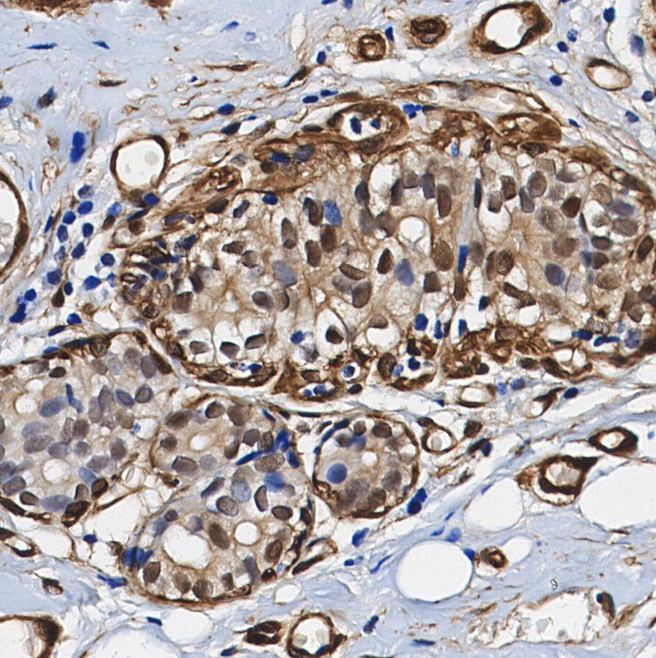 CUG-BP1 Antibody