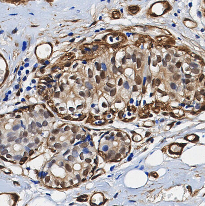 CUG-BP1 Antibody