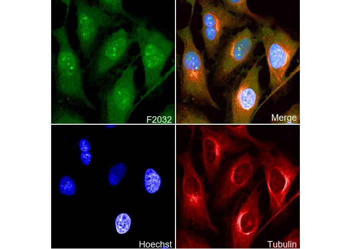 PI 3 Kinase p85 β Antibody