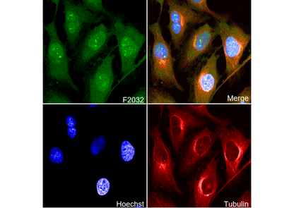 PI 3 Kinase p85 β Antibody