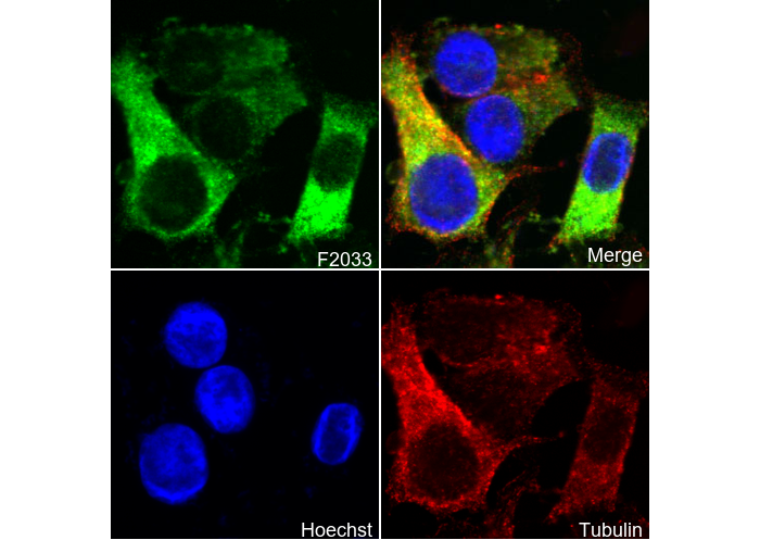 α Actinin 4 Antibody