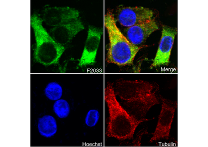 α Actinin 4 Antibody