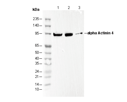 α Actinin 4 Antibody
