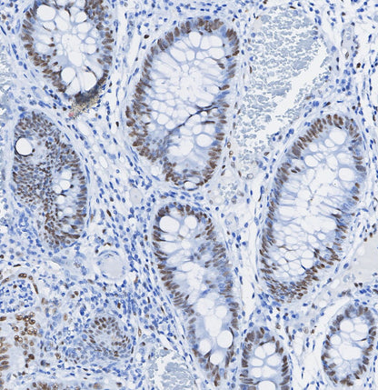 Topoisomerase I Antibody