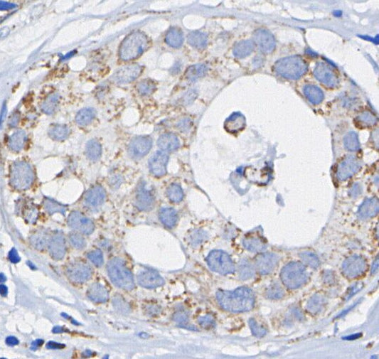 IL-18 Antibody