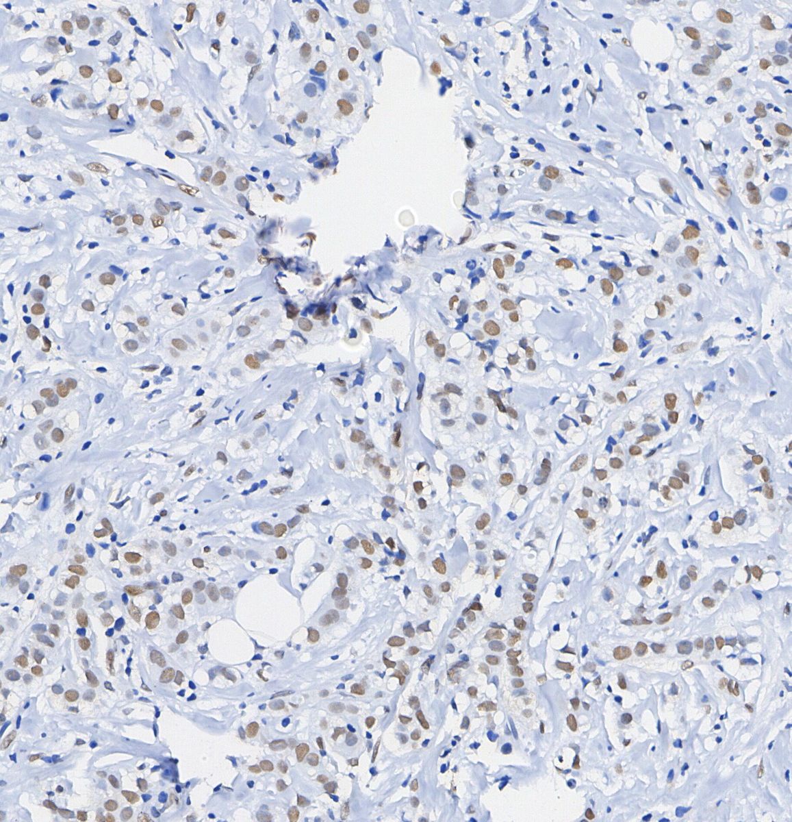 SMARCA2 / BRM Antibody