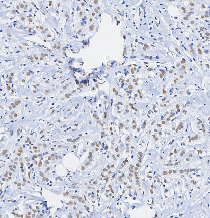 SMARCA2 / BRM Antibody