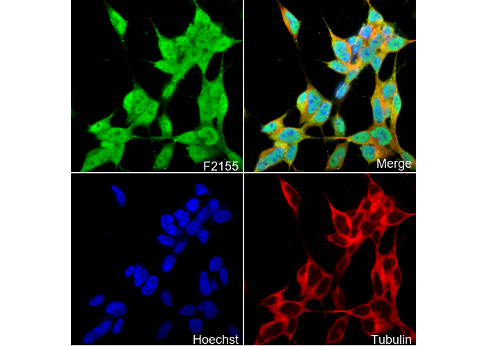 Choline Acetyltransferase Antibody