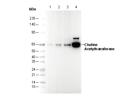 Choline Acetyltransferase Antibody
