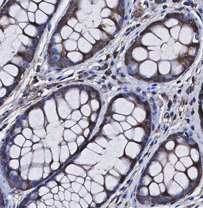 Lumican Antibody