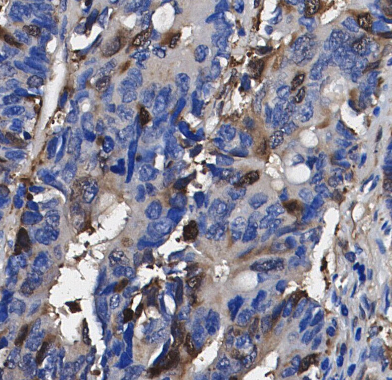 Niemann Pick C1 Antibody