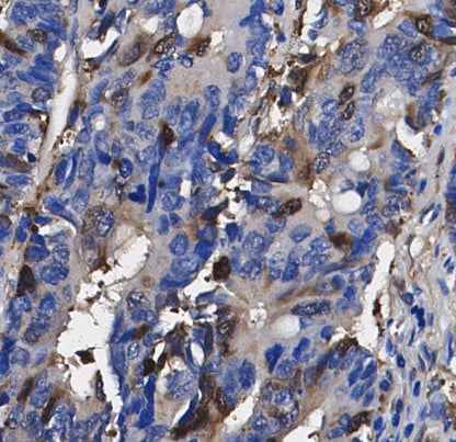 Niemann Pick C1 Antibody