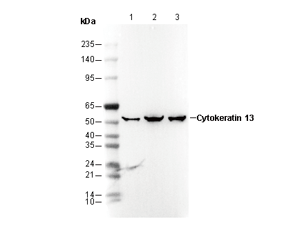 Cytokeratin 13 Antibody